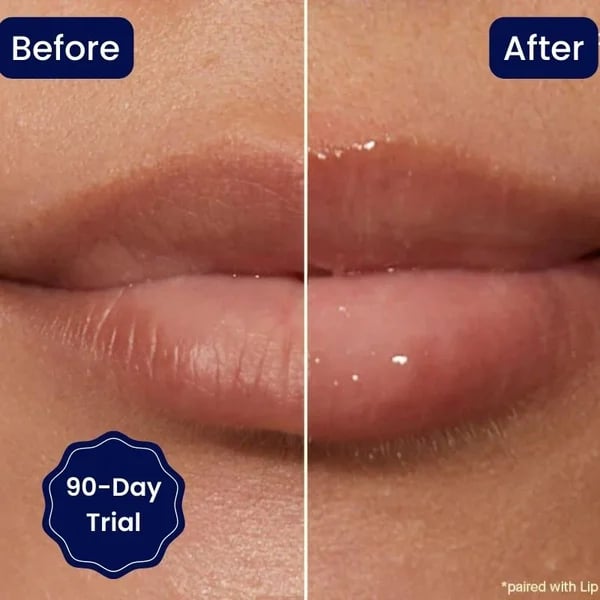 😍BIG SALE 🔥VITAMIN E LIP SERUM